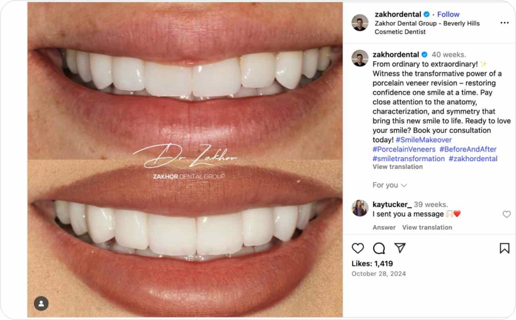 @zakhordental Instagram post