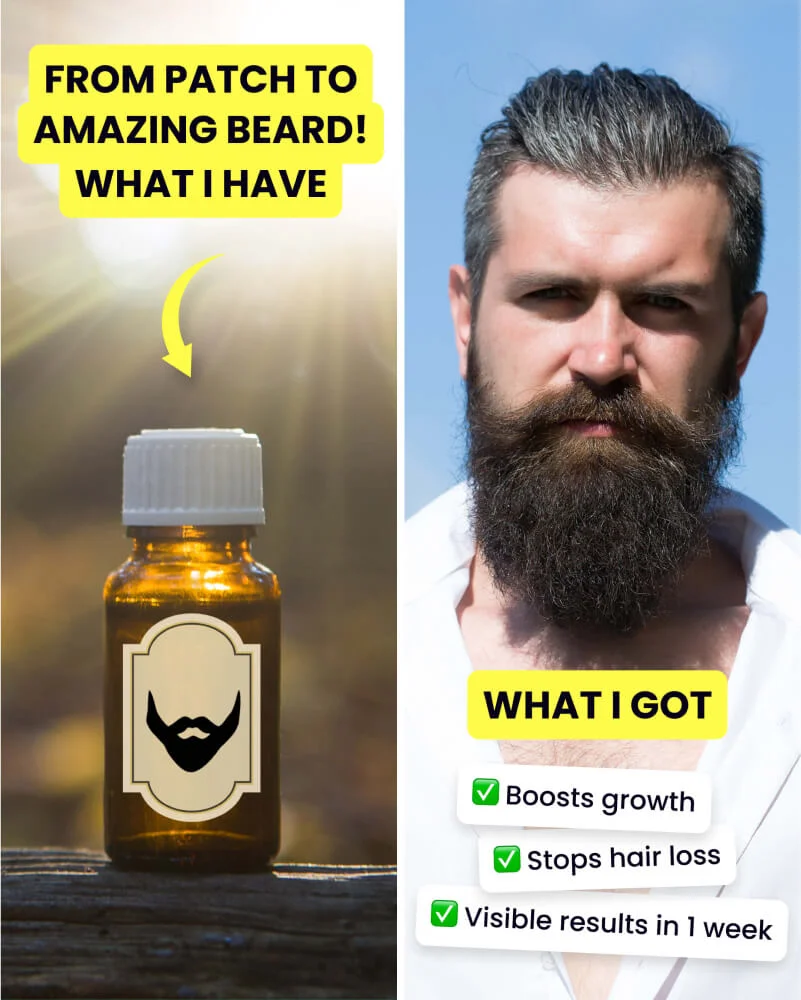 Beard growth oil before/after ad showing transformation with product benefits